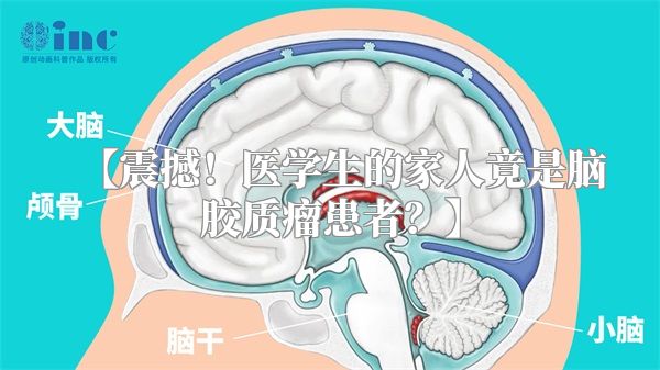 【震撼！医学生的家人竟是脑胶质瘤患者？】
