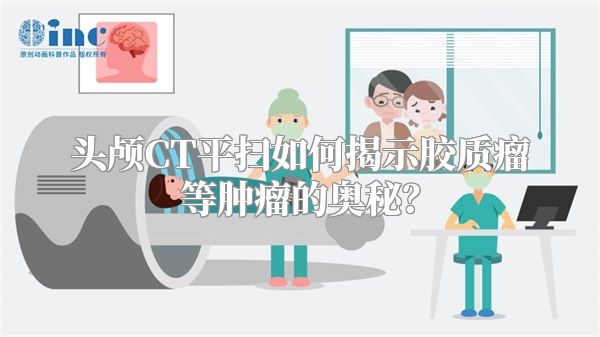 头颅CT平扫如何揭示胶质瘤等肿瘤的奥秘？