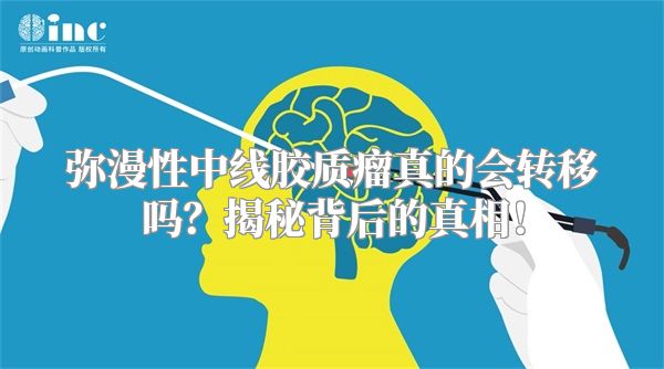 弥漫性中线胶质瘤真的会转移吗？揭秘背后的真相！