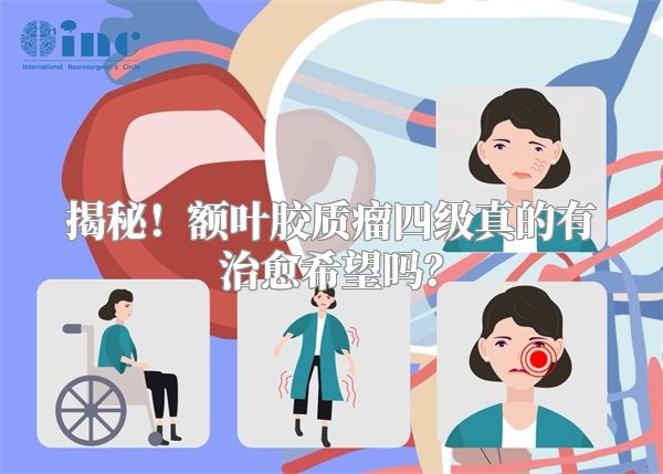揭秘！额叶胶质瘤四级真的有治愈希望吗？