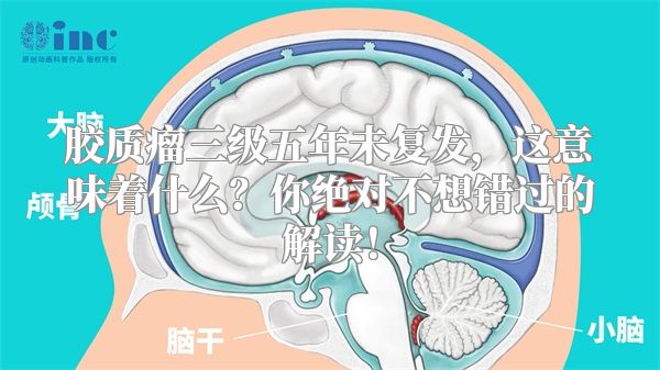 胶质瘤三级五年未复发，这意味着什么？你绝对不想错过的解读！