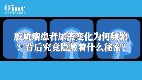 胶质瘤患者尿液变化为何频繁？背后究竟隐藏着什么秘密？