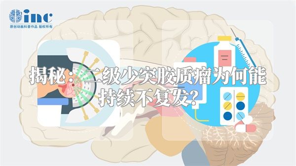 揭秘：二级少突胶质瘤为何能持续不复发？