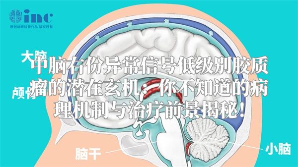 中脑右份异常信号低级别胶质瘤的潜在玄机：你不知道的病理机制与治疗前景揭秘！