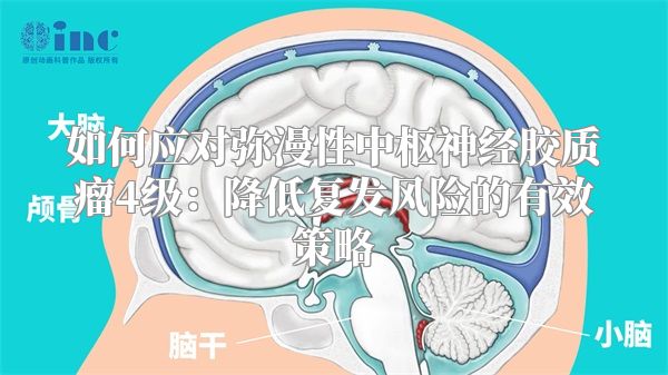 如何应对弥漫性中枢神经胶质瘤4级：降低复发风险的有效策略