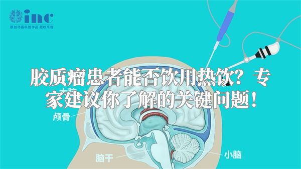 胶质瘤患者能否饮用热饮？专家建议你了解的关键问题！