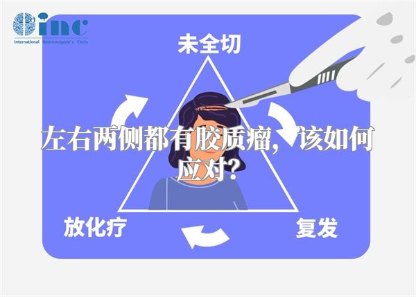 左右两侧都有胶质瘤，该如何应对？