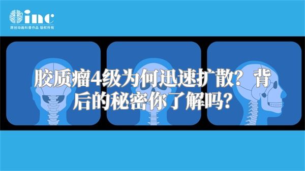 胶质瘤4级为何迅速扩散？背后的秘密你了解吗？
