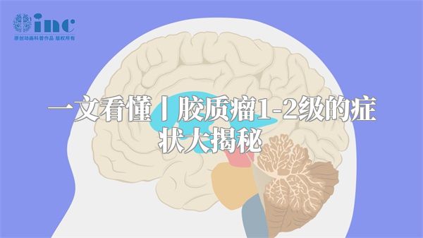 一文看懂丨胶质瘤1-2级的症状大揭秘