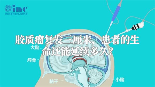 胶质瘤复发三厘米，患者的生命还能延续多久？
