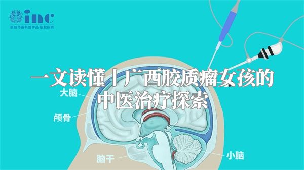 一文读懂丨广西胶质瘤女孩的中医治疗探索