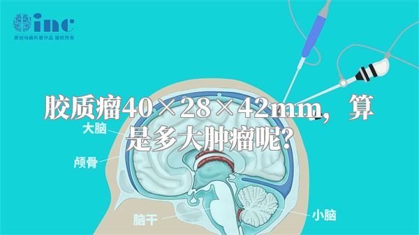 胶质瘤40×28×42mm，算是多大肿瘤呢？