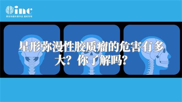 星形弥漫性胶质瘤的危害有多大？你了解吗？