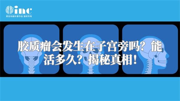 胶质瘤会发生在子宫旁吗？能活多久？揭秘真相！