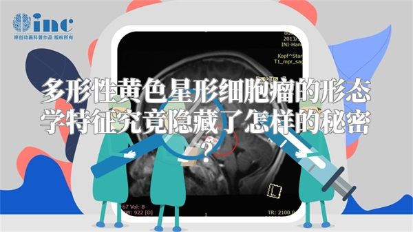 多形性黄色星形细胞瘤的形态学特征究竟隐藏了怎样的秘密？
