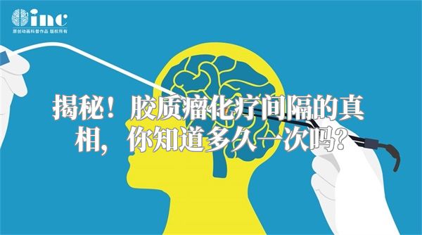 揭秘！胶质瘤化疗间隔的真相，你知道多久一次吗？