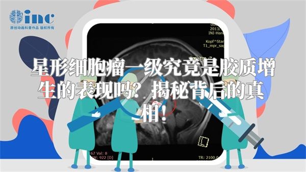 星形细胞瘤一级究竟是胶质增生的表现吗？揭秘背后的真相！