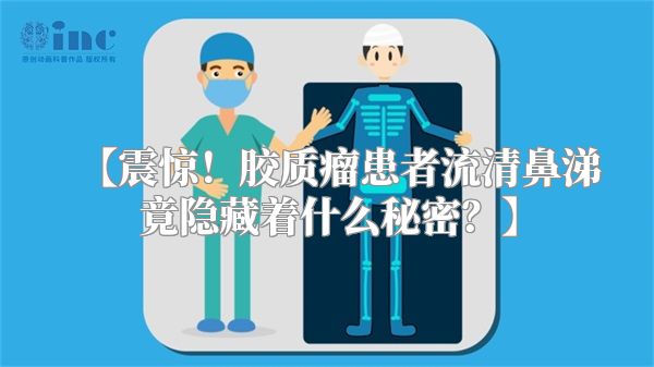 【震惊！胶质瘤患者流清鼻涕竟隐藏着什么秘密？】