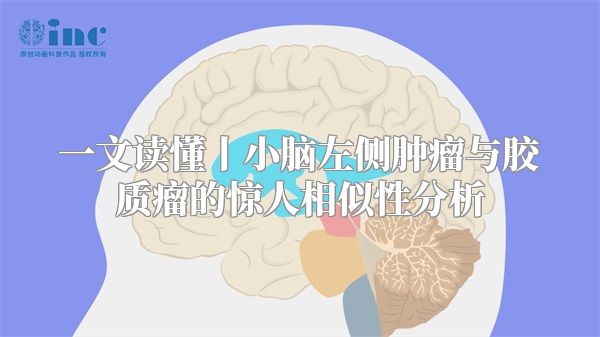 一文读懂丨小脑左侧肿瘤与胶质瘤的惊人相似性分析