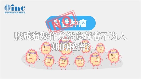 胶质瘤发作竟然隐藏着不为人知的秘密？