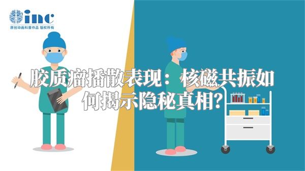 胶质瘤播散表现：核磁共振如何揭示隐秘真相？