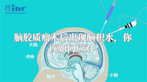 脑胶质瘤术后出现脑积水，你该如何应对？