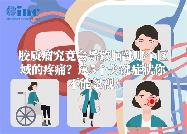 胶质瘤究竟会导致脑部哪个区域的疼痛？这5个关键症状你不能忽视！