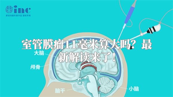 室管膜瘤11毫米算大吗？最新解读来了！