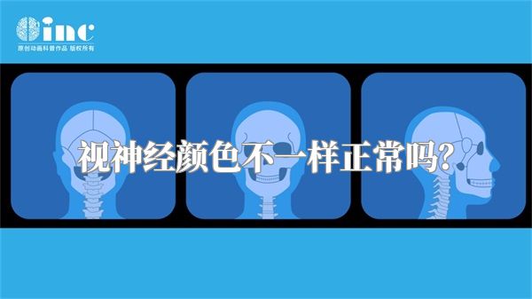 视神经颜色不一样正常吗?