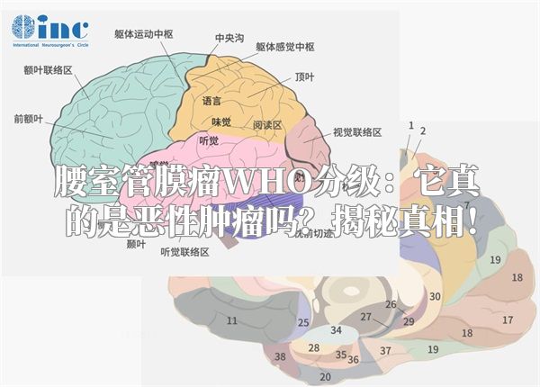 腰室管膜瘤WHO分级：它真的是恶性肿瘤吗？揭秘真相！
