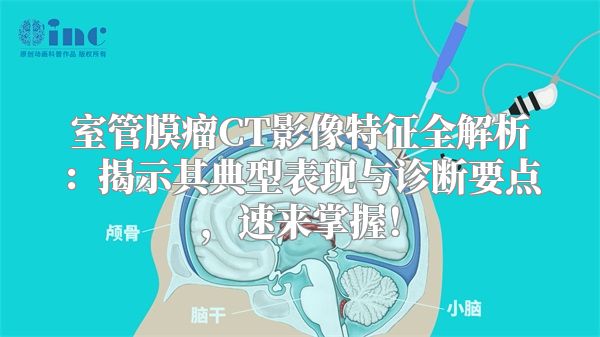 室管膜瘤CT影像特征全解析：揭示其典型表现与诊断要点，速来掌握！