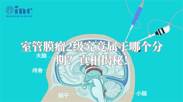 室管膜瘤2级究竟属于哪个分期？真相揭秘！