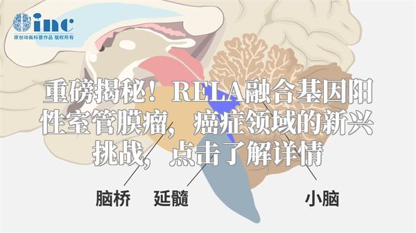 重磅揭秘！RELA融合基因阳性室管膜瘤，癌症领域的新兴挑战，点击了解详情