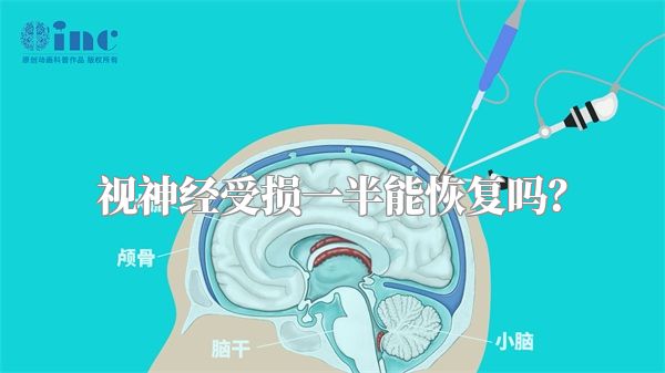 视神经受损一半能恢复吗？
