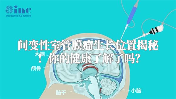 间变性室管膜瘤生长位置揭秘！你的健康了解了吗？