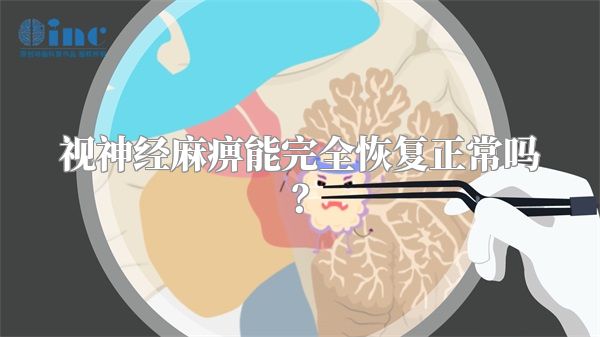 视神经麻痹能完全恢复正常吗？