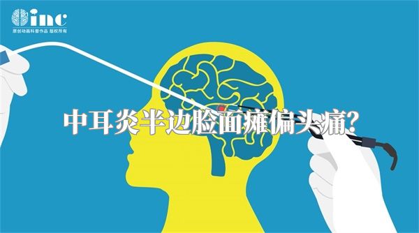 中耳炎半边脸面瘫偏头痛？