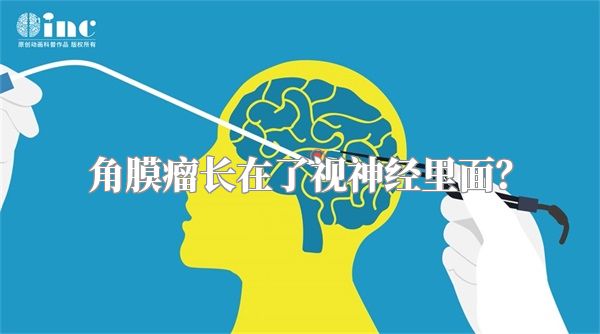 角膜瘤长在了视神经里面?