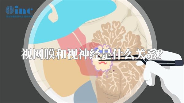 视网膜和视神经是什么关系?