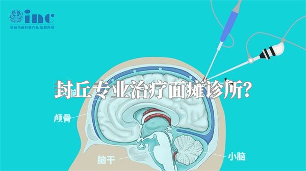 封丘专业治疗面瘫诊所？