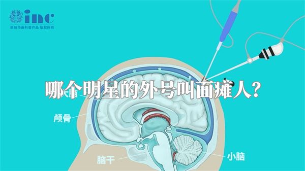 哪个明星的外号叫面瘫人？