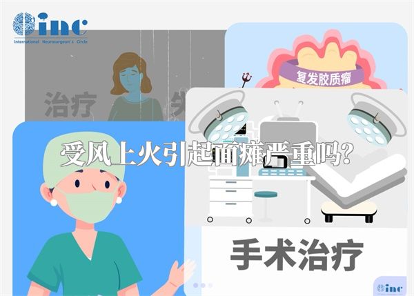 受风上火引起面瘫严重吗？