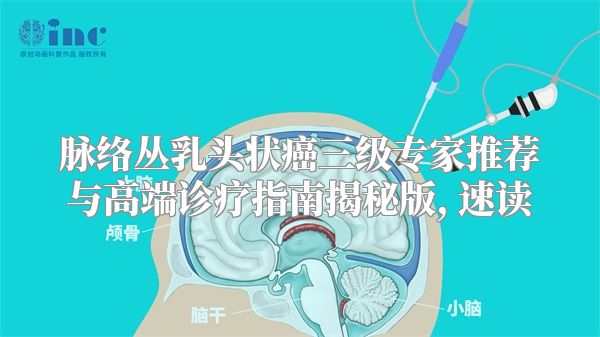 脉络丛乳头状癌三级专家推荐与高端诊疗指南揭秘版, 速读