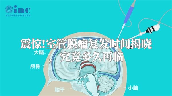 震惊!室管膜瘤复发时间揭晓，究竟多久再临