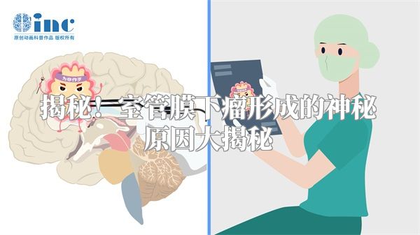 揭秘！室管膜下瘤形成的神秘原因大揭秘