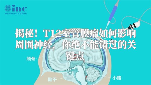 揭秘！T12室管膜瘤如何影响周围神经，你绝不能错过的关键点