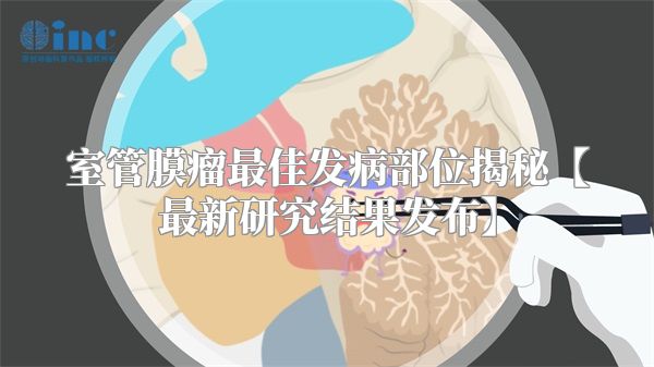 室管膜瘤最佳发病部位揭秘【最新研究结果发布】