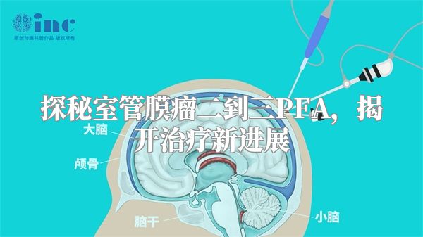 探秘室管膜瘤二到三PFA，揭开治疗新进展