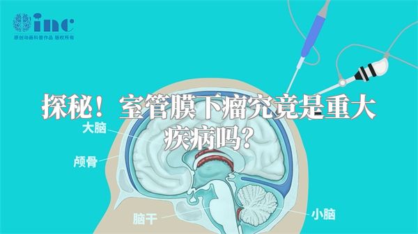 探秘！室管膜下瘤究竟是重大疾病吗？