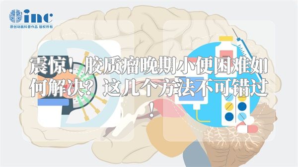 震惊！胶质瘤晚期小便困难如何解决？这几个方法不可错过！